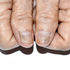 discoloured nails