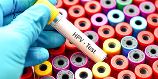 HPV test