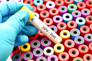 HPV test