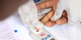 HIV test