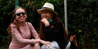 Kenyans living with albinism