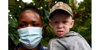 Kenyans living with albinism