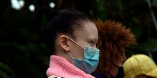 Kenyans living with albinism