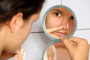 Acne is a skin caused by clogged pores and bacteria on the skin.