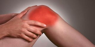 Arthritis 