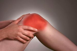 Arthritis 