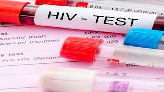 HIV testing