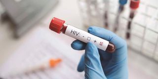 HIV testing