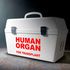 rgans transplant kidney donation