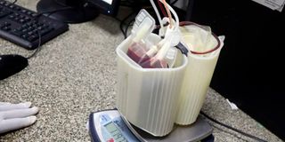 sicklers, blood donation, blood banks, blood shortage