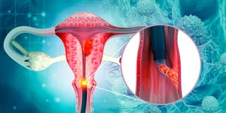 cancer war, kmtc, cancer machines