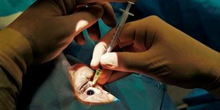 cornea, cornea transplant, organ donation, 