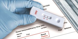 HIV test kit