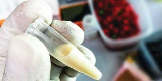 A scientist or Biochemist holds a test tube with a Lipemic blood sample. 