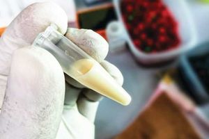 A scientist or Biochemist holds a test tube with a Lipemic blood sample. 