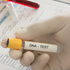 dna testing