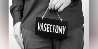 vasectomy