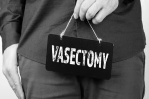 vasectomy