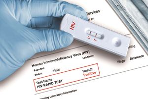 HIV test 