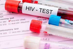HIV test.
