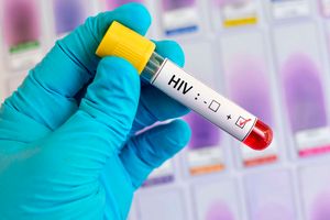 A long-term HIV prevention