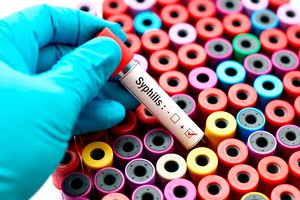 Syphilis testing