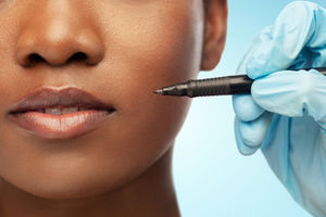 pen face cosmetic surgery