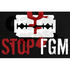 FGM