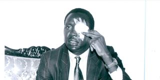 Otieno K'Opiyo shows journalists the injuries he sustained in a confrontation