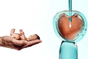 ivf (1)