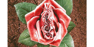 Vaginoplasty 