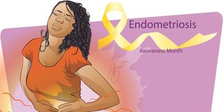 Endometriosis