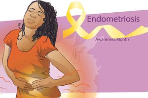 Endometriosis