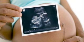 Foetus