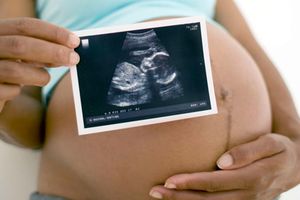 Foetus
