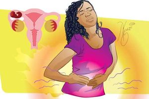 Ectopic pregnancy