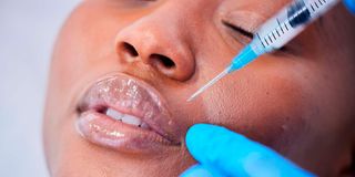 Lip enhancement