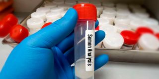 Semen testing