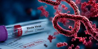 Ebola virus