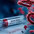 Ebola virus