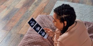 Ultrasound